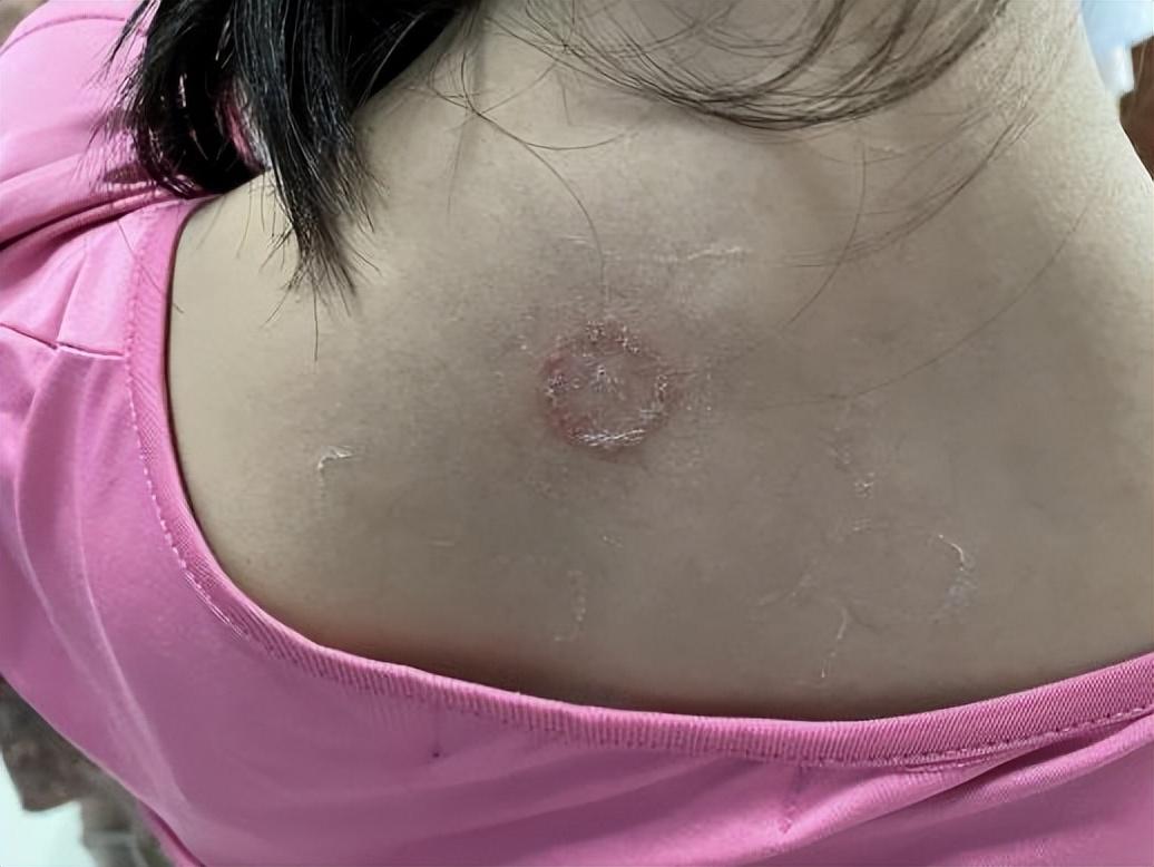 尤卓爾軟膏價格大解密，重磅揭秘真實(shí)價格??