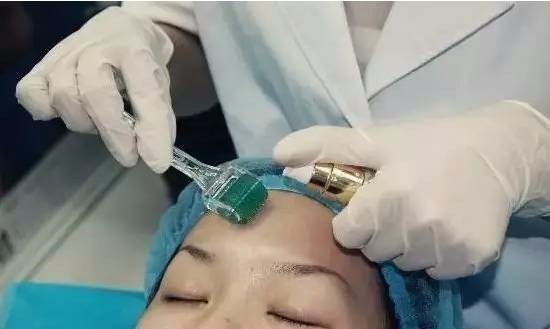 果酸換膚成本與代價(jià)揭秘，美麗背后的價(jià)格標(biāo)簽