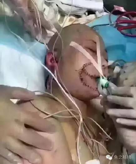 被虎咬的女子的最新消息，日常中的奇遇時刻